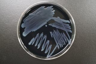 BCYE培地上でのレジオネラ属菌の写真