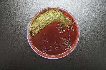 大腸菌群の写真