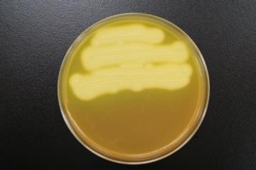 卵黄加CW培地上でのウエルシュ菌の写真