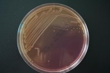 CT−SMAC培地上での腸管出血性大腸菌O157の写真