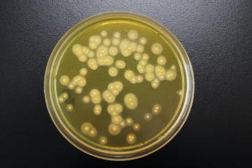 卵黄加マンニット培地上での黄色ブドウ球菌の写真