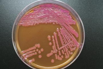 SS寒天培地上での赤痢菌の写真
