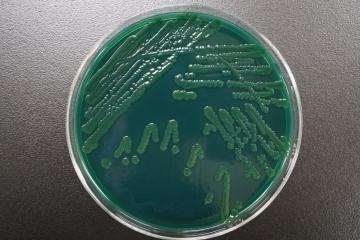 TCBS培地上での腸炎ビブリオの写真